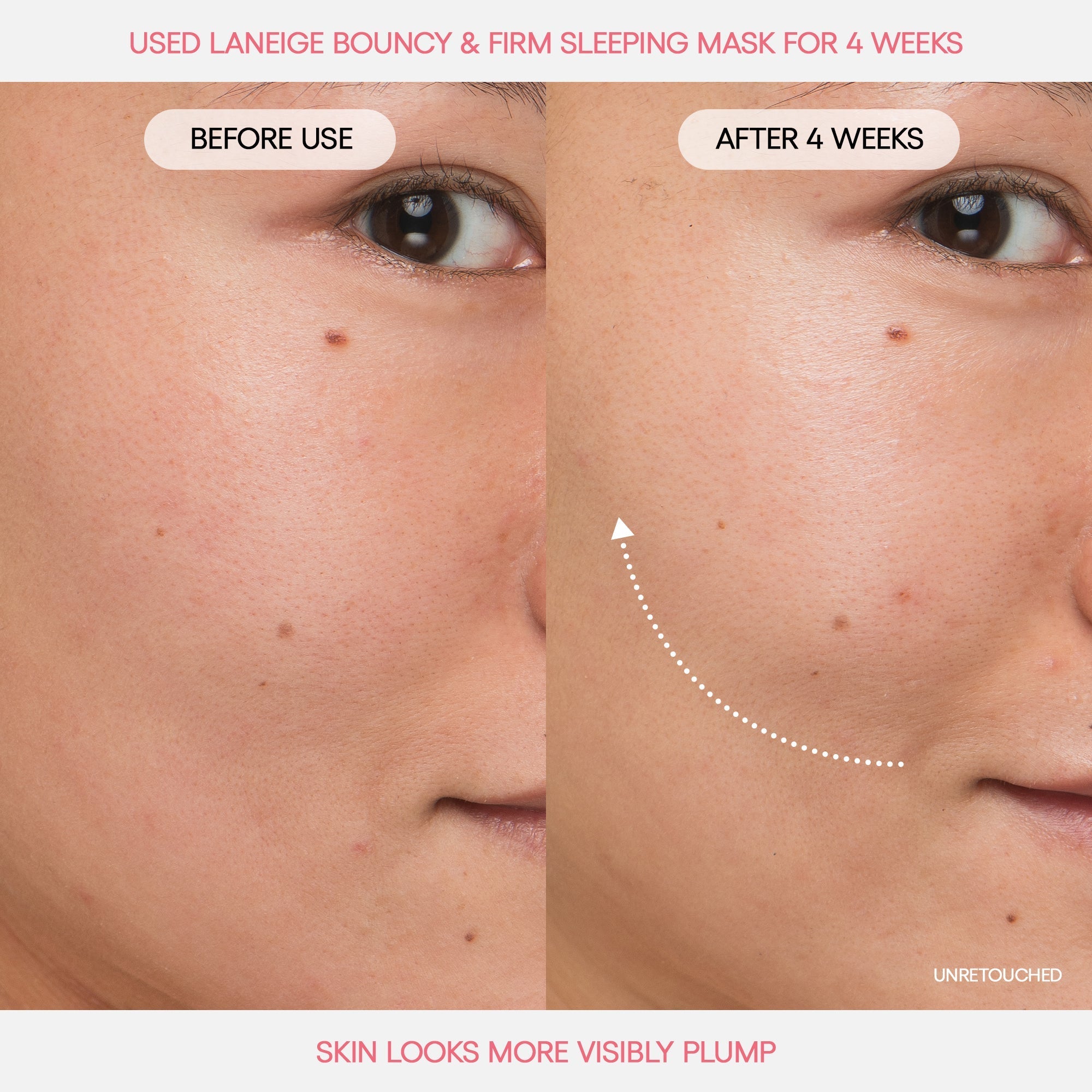 Bouncy Skin On The Go
